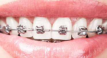 ortodonta katowice